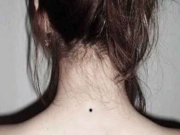 Nốt ruồi đằng sau gáy nam nữ có ý nghĩa gì?